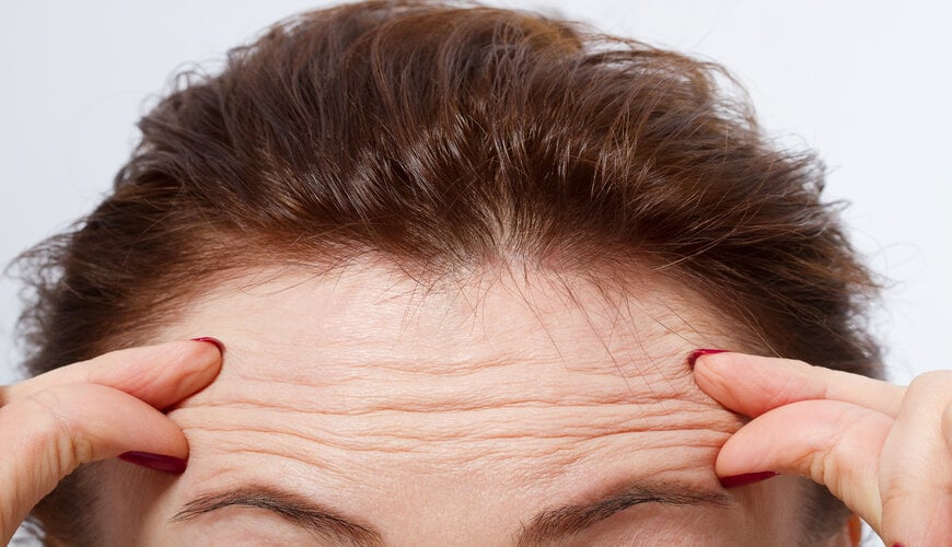 Nếp nhăn trên mặt: Thông tin cơ bản cần biết để giảm nếp nhăn